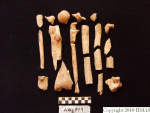 L_V20d5067 A16q84.4 R827 lR ta  human bones in q-lot